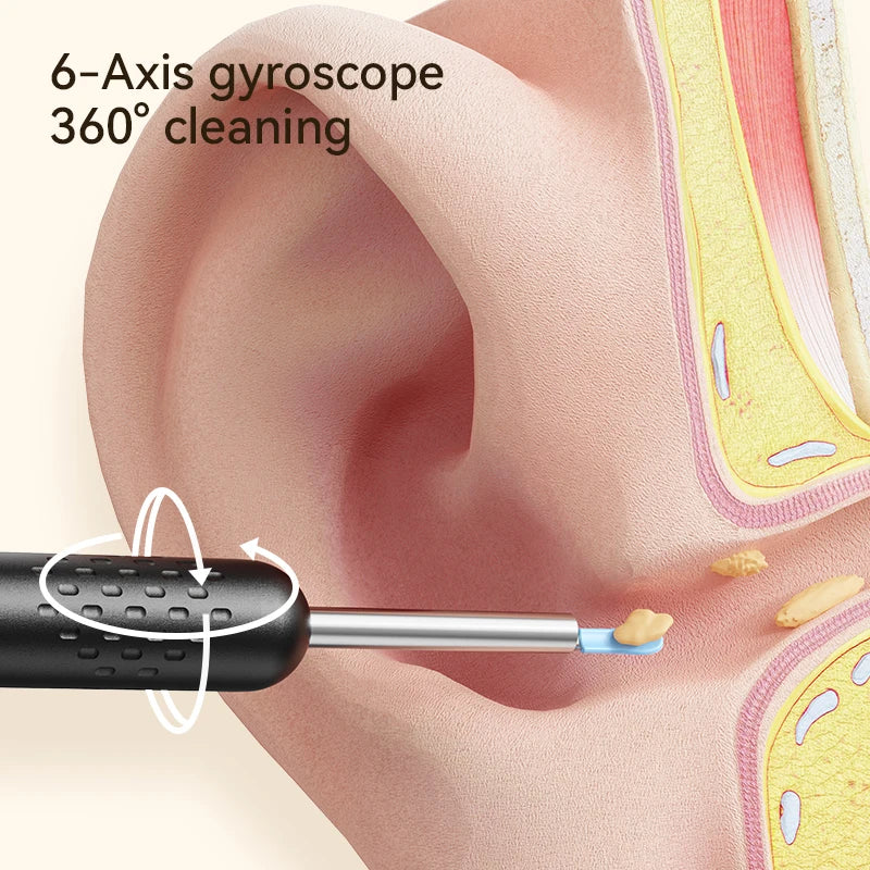 Ear Wax Removal Tool with Camera